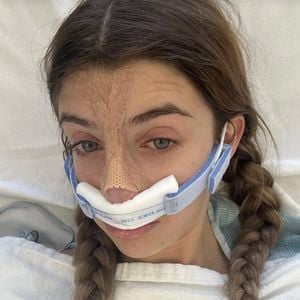 Nach Mobbing: Darum ließ sich Sami Sheen die Nase operieren