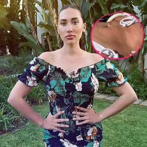 Nach zwei Kindern: Samira Yavuz zeigt ihren "Mamabauch"