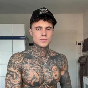 Erneute OP: Samuel Dohmen teilt besorgniserregendes Update