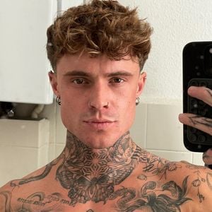 Lebensbedrohlich: GNTM-Star Samuel Dohmen wurde notoperiert