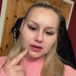 "Katastrophe": Sarah-Jane Wollny zeigt Lippenunterspritzung