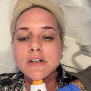 "Speckhals": Sarah Knappik unterzieht sich Beauty-Behandlung