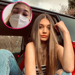 Ex-GNTM-Sarahs Gesicht bis zur Unkenntlichkeit angeschwollen