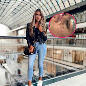 Hier bekommt BTN-Star Nathalie Bleicher-Woth Sommersprossen!