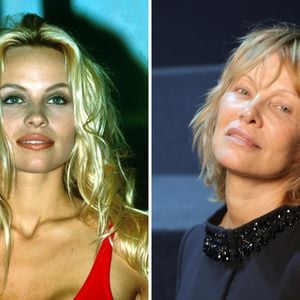 Vom Sexsymbol zur Ikone: So veränderte sich Pamela Anderson
