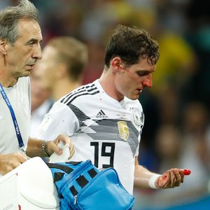 Tritt ins Gesicht: Sebastian Rudy muss blutend vom WM-Rasen!
