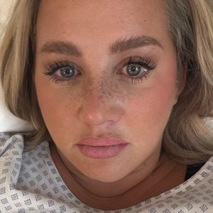 Nach Brust-OP: Citamaass kämpfte mit Wundheilungsstörung