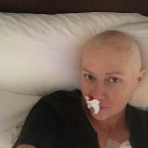 Blutende Nase: Shannen Doherty teilt ungeschönte Krebsfotos