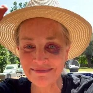 Sharon Stone verrät, was hinter ihrem blauen Auge steckt