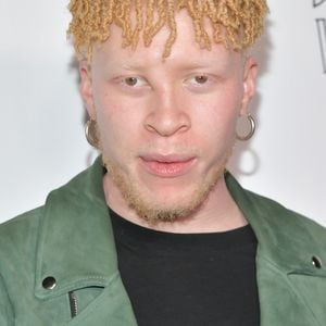 Grusel-Style! So rockt Albino-Model Shaun Ross das Coachella