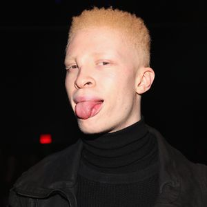 Albinomodel Shaun Ross: Hingucker auch ohne Kostüm