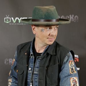 Nach seinem Unfall: Sid Wilsons Gesicht war "geschmolzen"