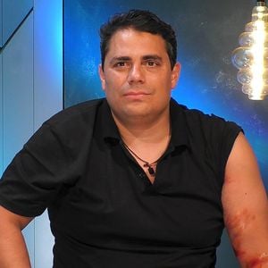 Wegen Schürfwunden: Gibt "Prominent getrennt"-Silva auf?