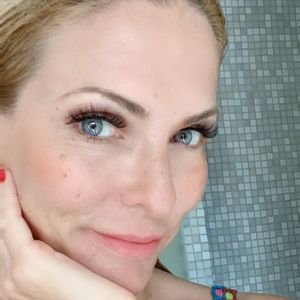 Folgen der Chemo: Sonya Kraus hat eine Glatze am Hinterkopf