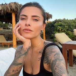 Gefäßmissbildung: Sophia Thomalla hat unheilbare Krankheit