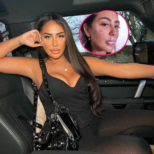Sophie Kasaei zeigt sich nach ihrer Tränensackbehandlung