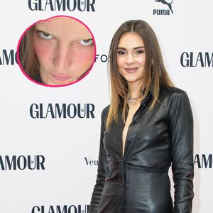 Behält Stefanie Giesinger ihre hellblonden Augenbrauen?