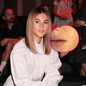 Damenbart – und wenn schon? Stefanie Giesinger steht dazu!