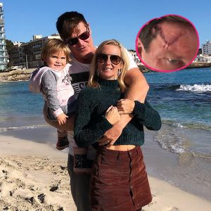 XXL-OP-Narbe: Steff Jerkels Tochter erschreckte sich vor ihm