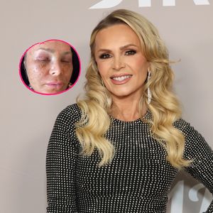 Nach Schönheits-OP: Tamra Judge ist kaum wiederzuerkennen