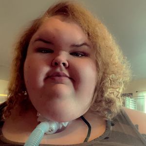 "Unser Leben mit 500 kg"-Tammy will nach Atem-Schock kämpfen