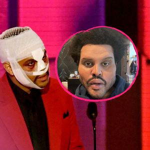 The Weeknd erklärt sein "Plastik-Gesicht" aus Musikvideo
