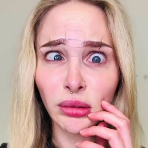 Schönheits-OP? Theresia Fischer war beim Beauty-Doc!