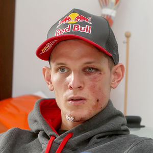 Horror-Sturz! Top-Skispringer auf Intensivstation