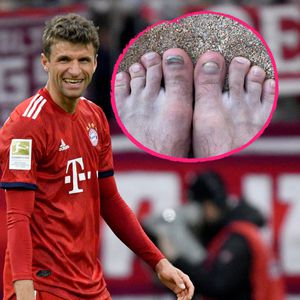 Kickerleiden: Thomas Müller witzelt über kaputte Fußnägel