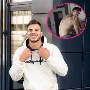 Heftige Abdrücke: Tim Stammberger wurde geschröpft
