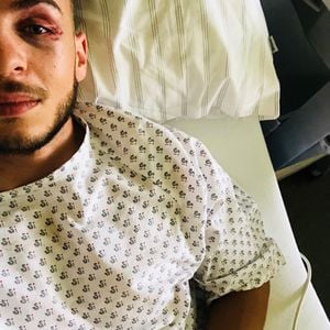 Tim Stammberger schockt Follower mit altem Unfall-Foto