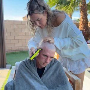 Kampf gegen Haarausfall: Tobi Wolf rasiert sich eine Glatze