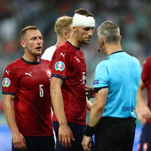 Blut am Kopfverband: Tschechien-Kicker spielt einfach weiter