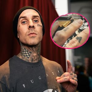 Travis Barker bricht sich zum zweiten Mal seinen Finger