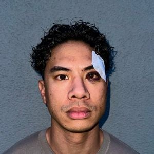 Auf offener Straße: Comedian Tutty Tran wurde verprügelt