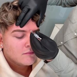 Twenty4tim (22) erzählt offen: Er lässt sich Botox spritzen!