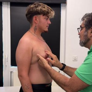 Beauty-OP: Twenty4tim lässt sich "Männerbrust" absaugen
