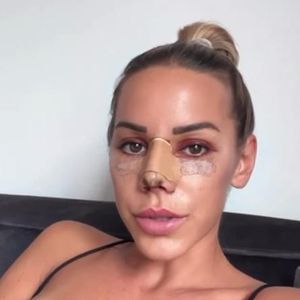 Gesundheitliche Gründe: Vanessa Mariposa hatte eine Nasen-OP