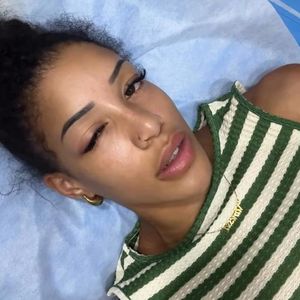 Angeschwollenes Auge: Vanessa Nwattu sucht Krankenhaus auf