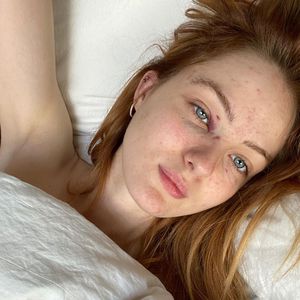 Vanessa Tamkan hat sich Schraubenzieher ins Gesicht gerammt!
