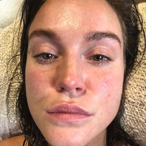 Besuch in Kinderwunsch-Klinik: Vicky Pattison bereut Exzesse