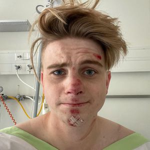 Blutiges Gesicht: Schlagerstar Vincent Gross im Krankenhaus