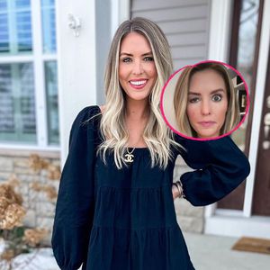 Botox-Unfall: Influencerin kann ihr Auge nur halb öffnen!