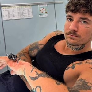 Gendefekt: Willi Whey ließ sich kleinen Finger verlängern