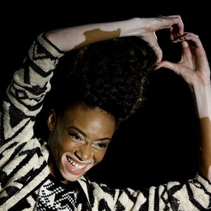 Hautleiden, na und? Winnie Harlow rockt die NYFW