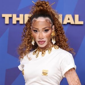 Transparenter Zebra-Look: Winnie Harlow sorgt für Aufsehen