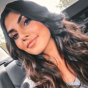 Aus Angst vor Nadeln: Auf diese Beauty-OP verzichtet Yeliz