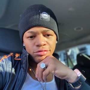 Hat Sänger YK Osiris seiner Freundin ins Gesicht gebissen?