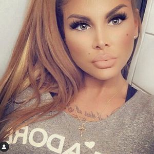 Horror-Erlebnis: Sommerhaus-Lisha wurde bei Brust-OP wach