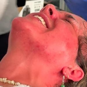 Versehen: Yvonne Pferrer sprüht sich Bärenspray ins Gesicht